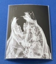 2024 Topps Allen & Ginter X-Ray’d Black Bear #XR-11 card